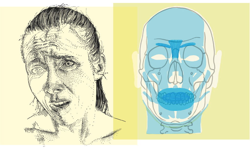 Mimik mit Darstellung der Muskeln